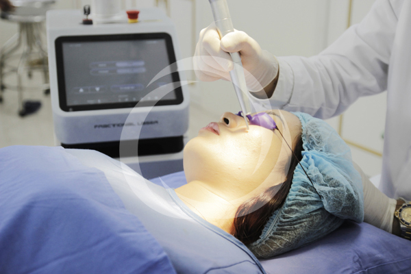 Điều trị sẹo bằng công nghệ Laser siêu xung trimunthit (16)
