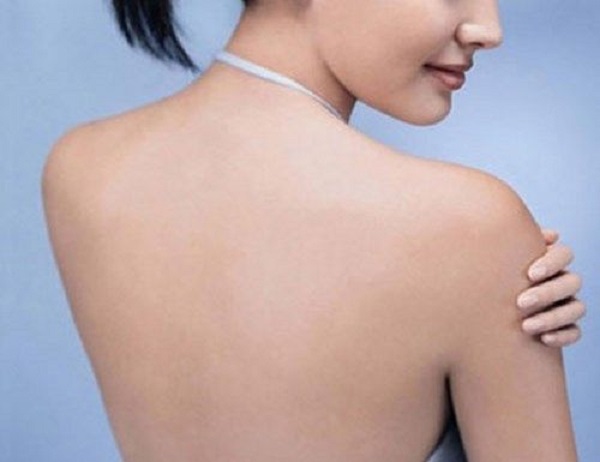 Hi vọng làn da lưng mịn màng khi điều trị tại TMV uy tín hành trình trị mụn thịt ở lưng