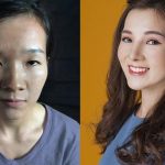 5 ca phẫu thuật thẩm mỹ thành công của Việt Nam năm 2017