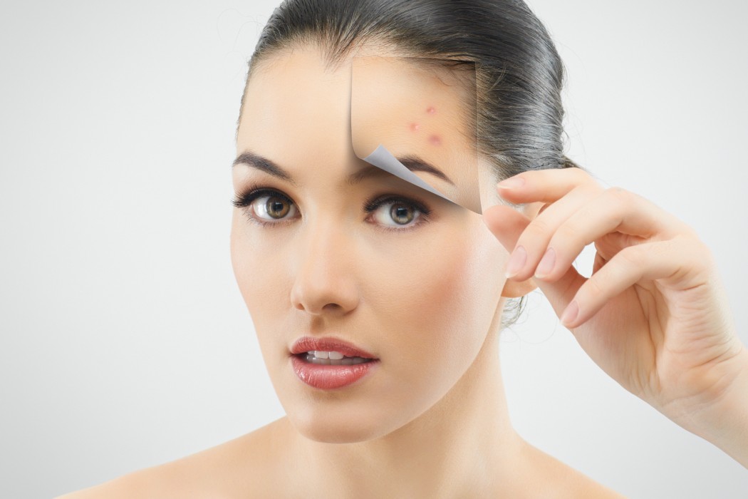 4 lí do bạn nên điều trị mụn thịt bằng Laser siêu xung